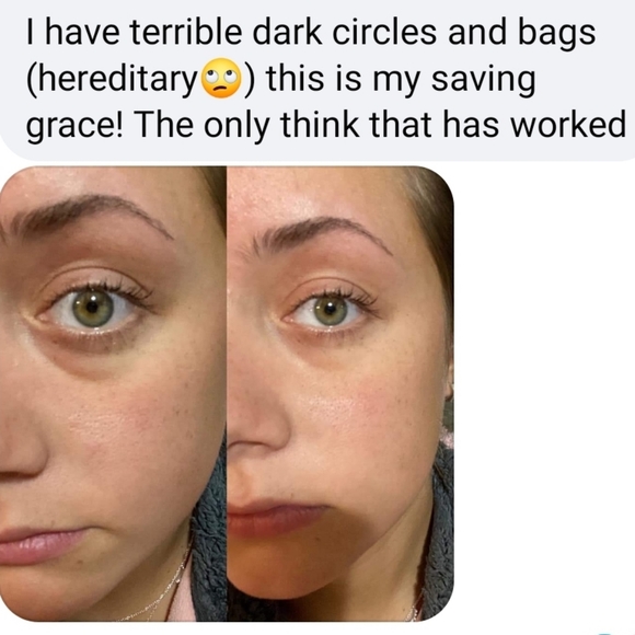 NEW! Rapid Rewind Wrinkle Reducer - Picture 10 of 16